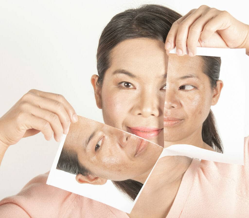 Woman improving her skin